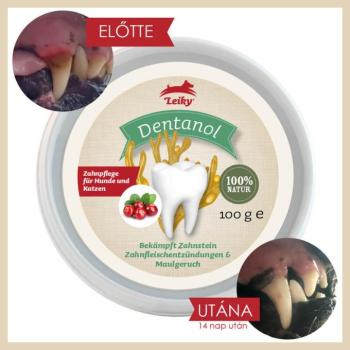 Leiky Dentanol 100% természetes fogkő, fogínygyulladás és szájszag elleni por 100g kép